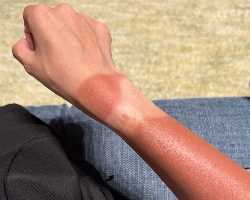 夏のサイクリングで日焼け止めを塗った方がいい理由
